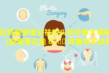 日照胶原蛋白祛抬头纹价格大揭秘(胶原蛋白能 🐅 改善抬头纹吗)